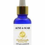 acne-and-scar. Acne Scar blend 20ml